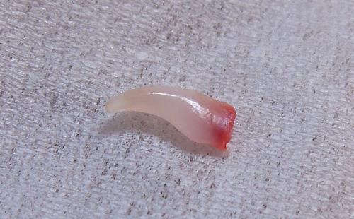 20140219乳歯犬歯